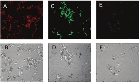 Photomicrographs Of C Albicans Germ Tubes Following Photofrin Download Scientific Diagram