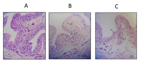 The Effect Of A Super Oxidized Solution On The Bladder Uroepithelium Of