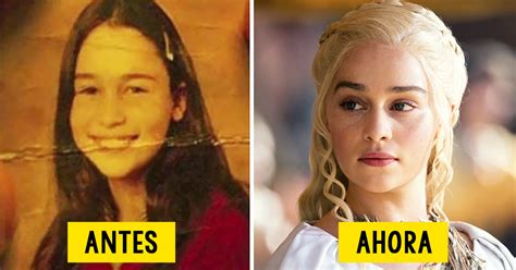 20 Antes y después de los actores de Juego de Tronos que muestran el