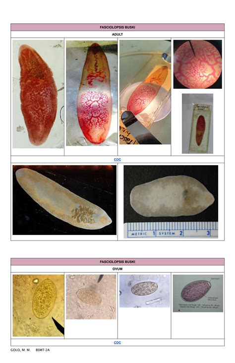 SOLUTION Parasitology Exercise 8C Intestinal Flukes Studypool