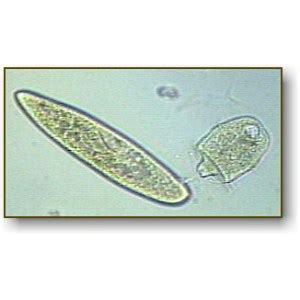 Didinium | Microbus Microscope Educational Website