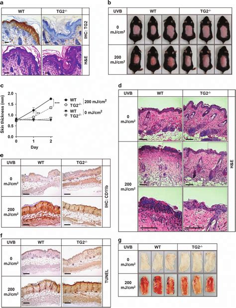 Tg2 − − Mice Exhibit Reduced Skin Inflammation In Response To Uv Download Scientific Diagram