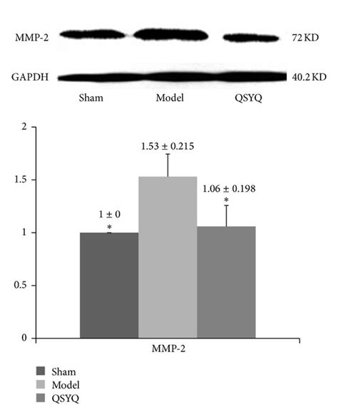 The Western Blot Results Of Mmp 2 In Different Groups Qsyq Qishenyiqi