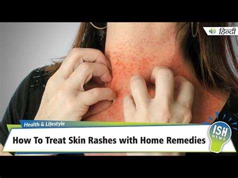 Common Face Rash Causes and Treatment, face on - mi-pro.co.uk