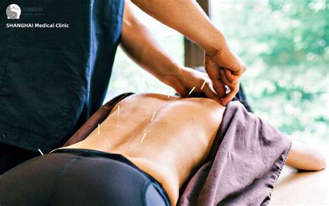 Acupuncture For Sciatica 3 Things You Need To Know Shanghai Medical