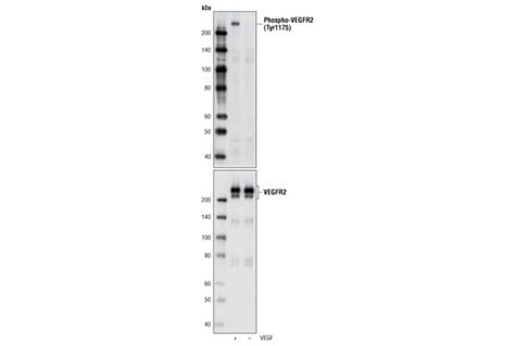 Phospho VEGF Receptor 2 Tyr1175 D5B11 Rabbit MAb Cell Signaling