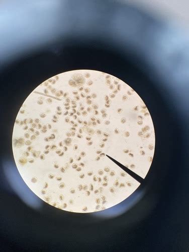 Parasite identification with microscope Flashcards | Quizlet