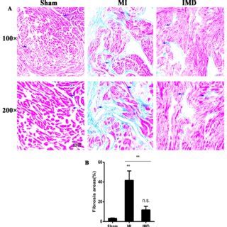 Effects Of Imd Treatment On Atrial Fibrosis After Mi Surgery A