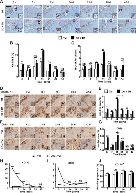 Corticotomy Induced Osteoclastogenesis And Macrophage Infiltration