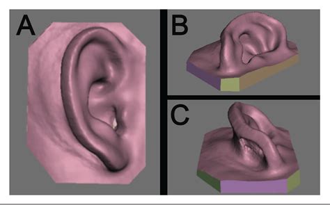 Figure 1 From Fabrication Of 3D Models For Microtia Reconstruction