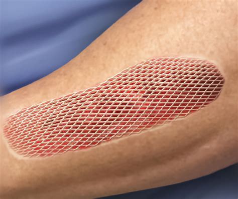 Looking For A Wound Care Specialist In Orlando Call Us Today