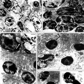 Histopathological Microphotographs Of Apoptosis In New Type Gosling