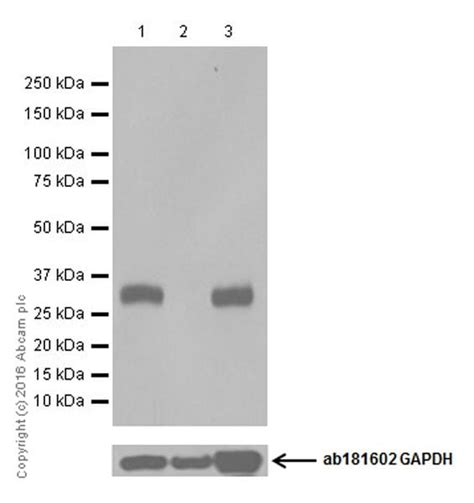Anti-UCP1 antibody (ab10983) | Abcam