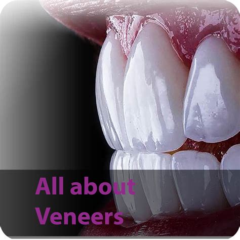 All About Veneers Complete Guide To Transform Your Smile Dr