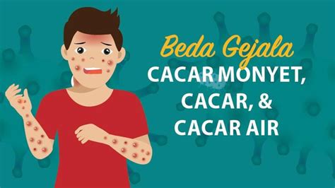 Kenali Perbedaan Gejala Cacar Cacar Air Dan Cacar Monyet