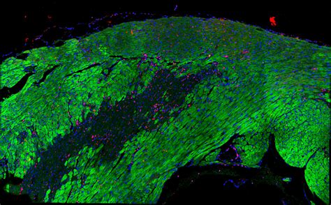 Heart Recovery After Heart Attack Mapped in Great Detail