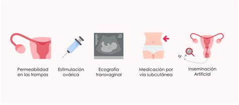 En Qu Consiste La Inseminaci N Artificial Con Donante De Semen