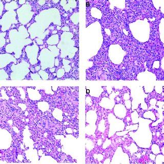 A Pathological Section Image Of The Lung Tissue Of Rats In Control