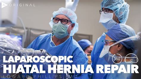 What Is The Newest Surgery For Hiatal Hernia At Anton Washington Blog