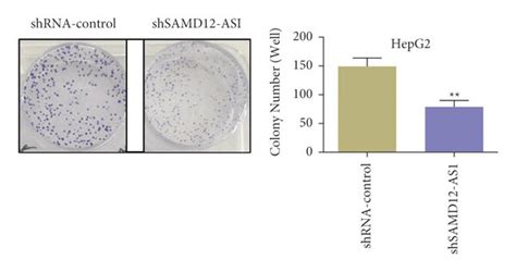 Knockdown Or Overexpression Of Lncrna Samd12 As1 Can Affect Liver