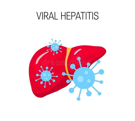 Viral Hepatitis Cartoon Liver Diagram Hepatic Virus C Failure Hcv