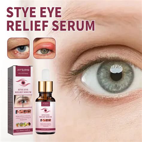 Stye Eye Treatment Eye Stye Remover Chalazion Remover Stye Eye Relief Serum For Styes