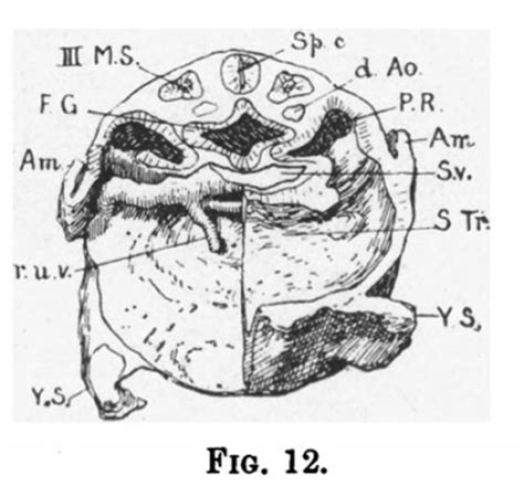 Paper - Description of a Human Embryo of 13-14 Mesodermic Somites ...