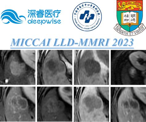 Lld Mmri2023 多相位mr肝脏病变诊断数据集介绍 知乎