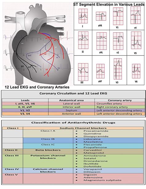 EKG Pocket Card: APRN World: 9781941004067: Amazon.com: Books ...