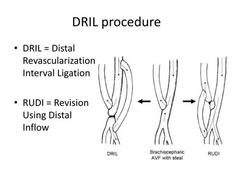 PPT Vascular And Intestinal Anastomotic Workshop PowerPoint