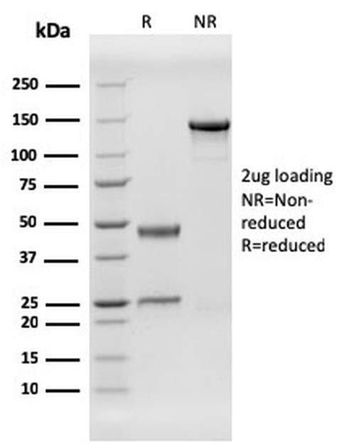 Human Herpes Virus 8 Hhv8 Recombinant Monoclonal Antibody Hhv8 3606