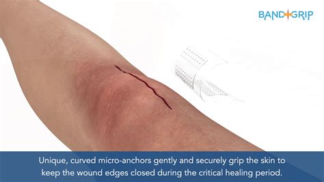 Surgery Scar Healing Stages