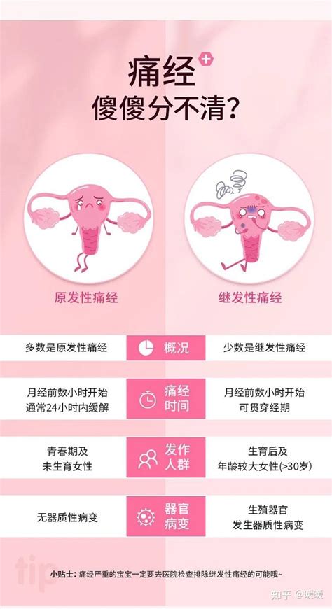 女性对痛经有哪些误区有什么方法可以根治呢 知乎