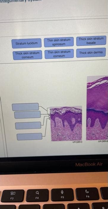 Solved \begin{tabular}{l} Stratum lucidum \\ Thin skin | Chegg.com