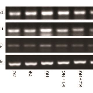 The Mrna Expression Of Nlrp Caspase And Il In Mesangial Cells