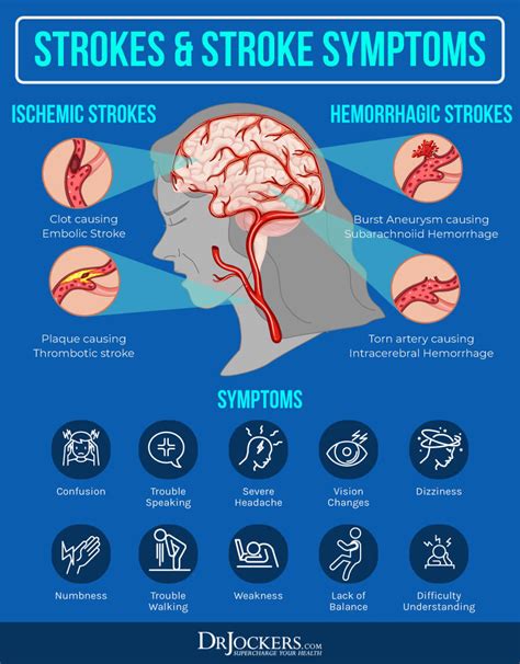 Dizziness Causes Symptoms Support Strategies