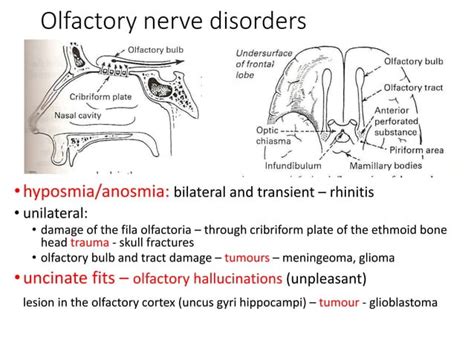 Cranial Nerve Examination And Lesionspptx