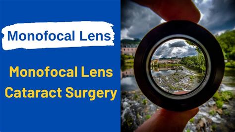 Monofocal Lens Monofocal Lens Cataract Surgery Cataract Surgery