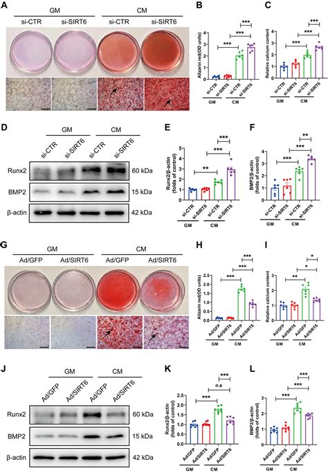 Deletion Of SIRT6 In Vascular Smooth Muscle Cells Facilitates Vascular