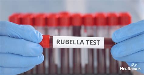 Rubella Igm And Igg Test Purpose Results And Range Healthians Blog