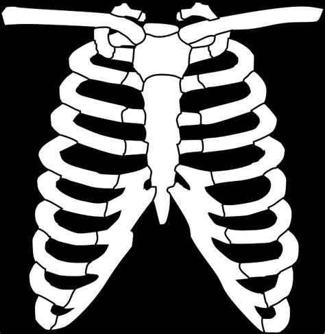 Ribs Anatomy Types Ossification Clinical Significance