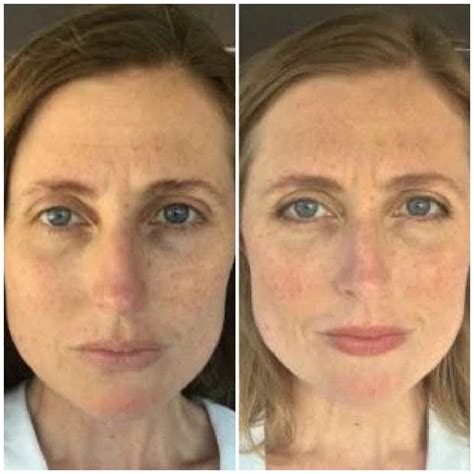 What Women In Their 40s Look Like With And Without Makeup Yourtango