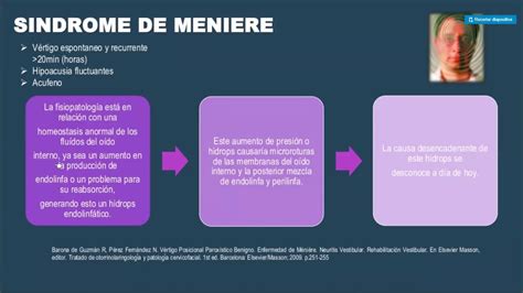 Sindrome De Meniere Laberintitis Neuronitis Vestibular Lesiones De V