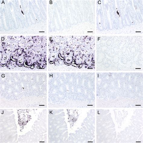 Chromogenic In Situ Hybridization Cish Of Intestinal Tissue Sections