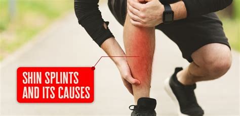 Shin Splints And Its Causes FNS Training Center