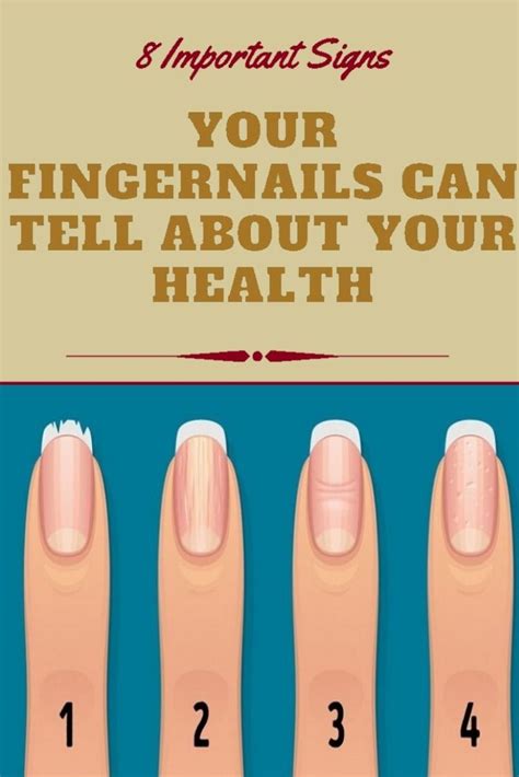 Fingernail Health Signs