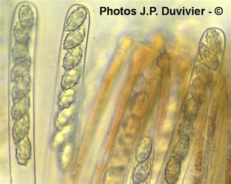 Microscopie Asques De Aleuria Aurantia Peziza Aurantia J