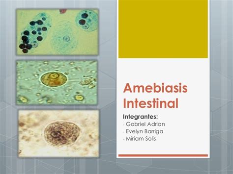 Amebiasis