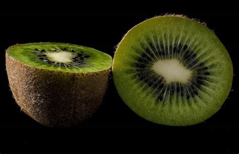 The Amazing Health Benefits Of Kiwi Fruit