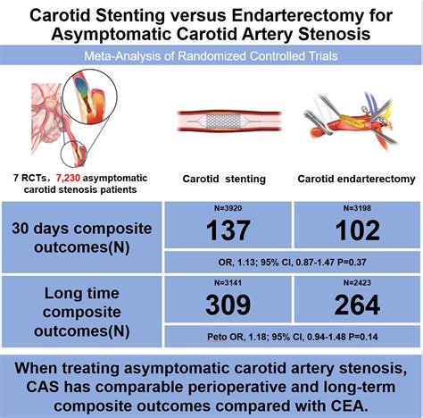 management  extracranial carotid artery disease bmt vrogueco